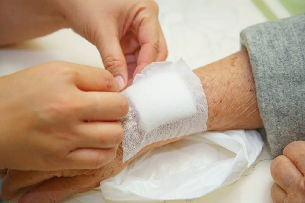 Can You Sue for Laceration Injuries?